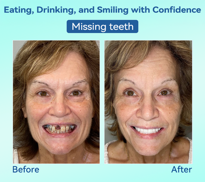 DIYSTAR™ 🍀𝐏𝐫𝐞𝐦𝐢𝐮𝐦 𝐃𝐞𝐧𝐭𝐮𝐫𝐞(🦷𝐋𝐢𝐦𝐢𝐭𝐞𝐝 𝐭𝐢𝐦𝐞 𝐝𝐢𝐬𝐜𝐨𝐮𝐧𝐭 𝐋𝐚𝐬𝐭 𝟑𝟎 𝐦𝐢𝐧𝐮𝐭𝐞𝐬🦷)