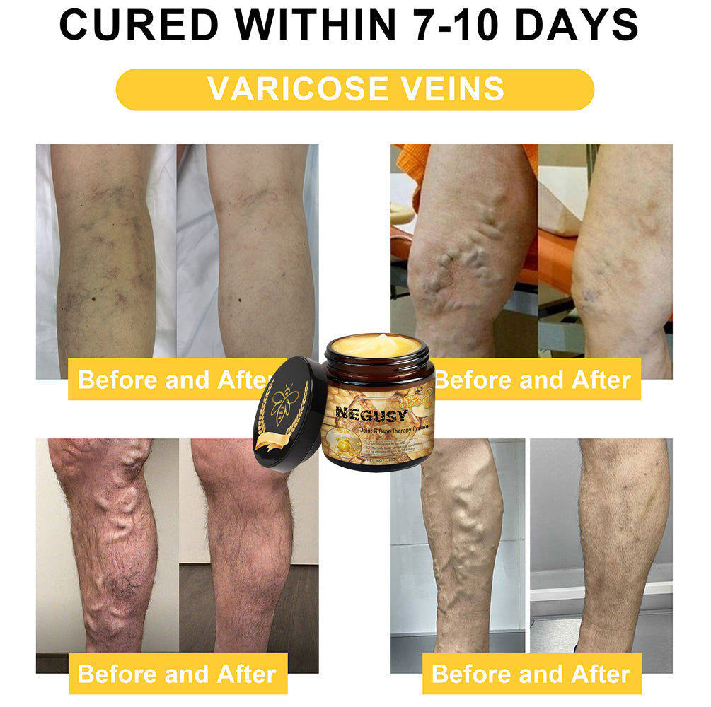 🐝Quick natural repair for sciatica, knee and back pain🐝