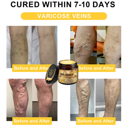 🐝Quick natural repair for sciatica, knee and back pain🐝