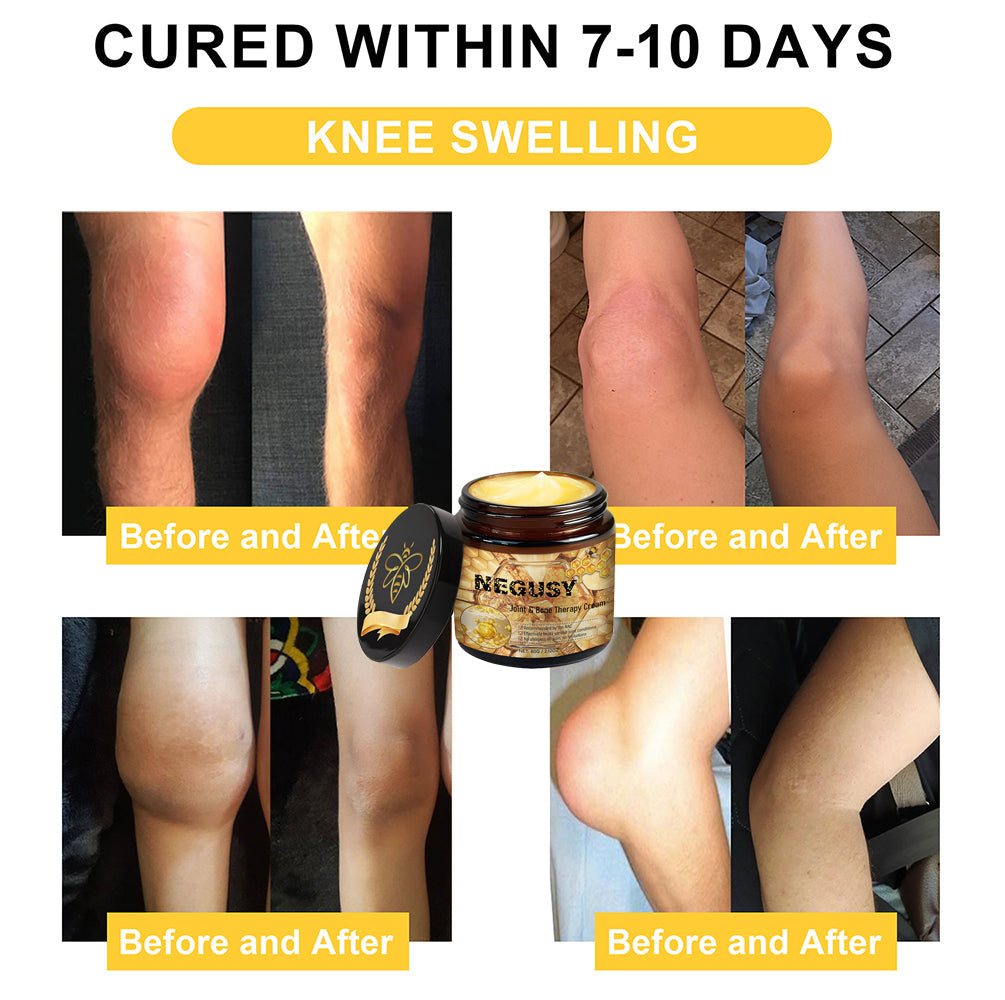 🐝Quick natural repair for sciatica, knee and back pain🐝