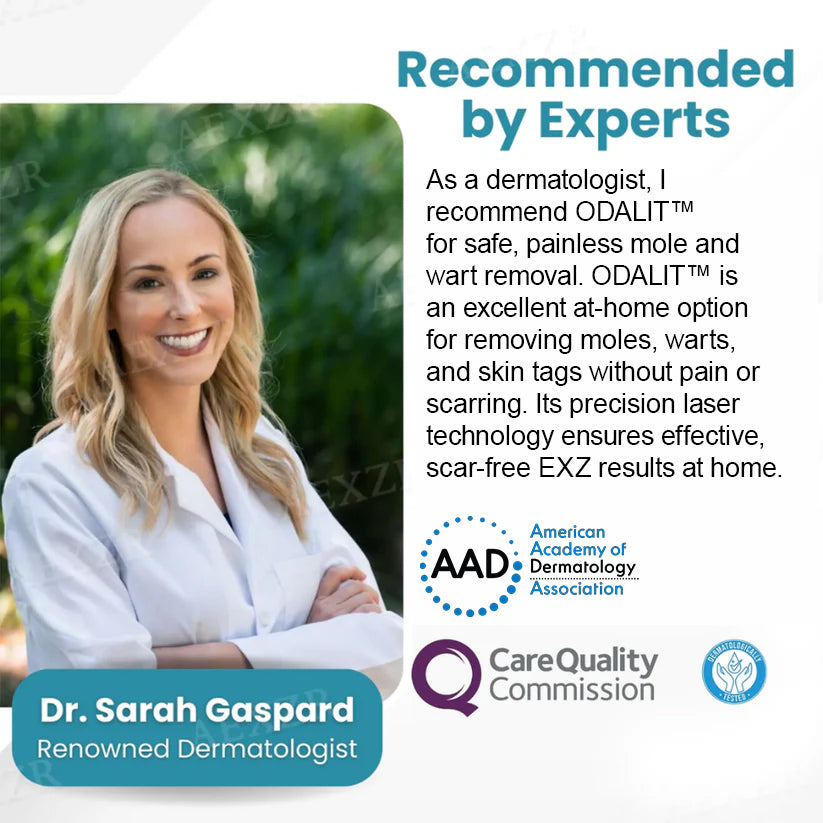 💥ODALIT™ Non-Invasive Mole and Wart Removal Laser Pen