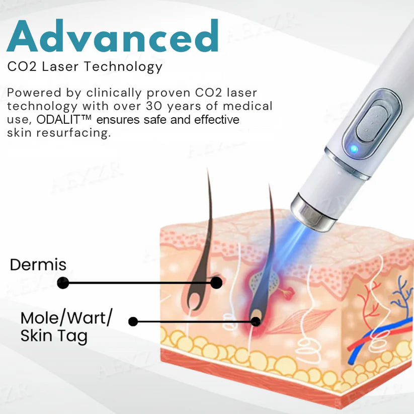 💥ODALIT™ Non-Invasive Mole and Wart Removal Laser Pen