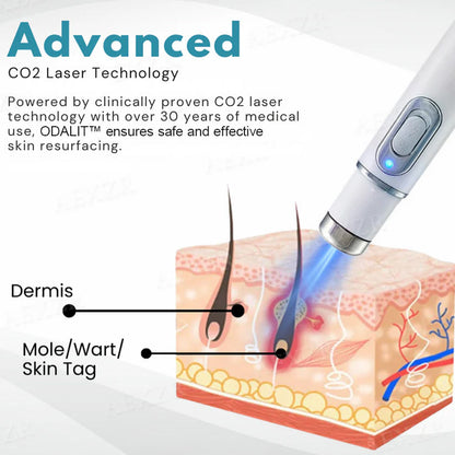 💥ODALIT™ Non-Invasive Mole and Wart Removal Laser Pen
