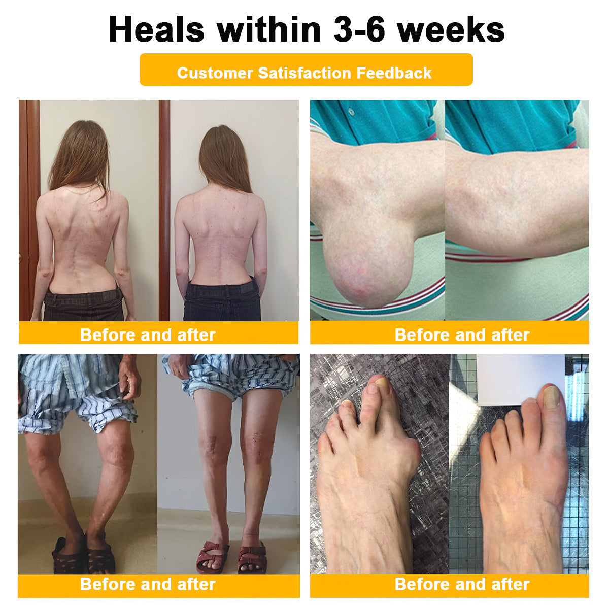 🔥Time-Limited Offer - ODALIT™ Botulinum Toxin & Bee Venom Pain-Relief Bone Healing Cream🐝💎