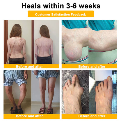 🔥Time-Limited Offer - ODALIT™ Botulinum Toxin & Bee Venom Pain-Relief Bone Healing Cream🐝💎