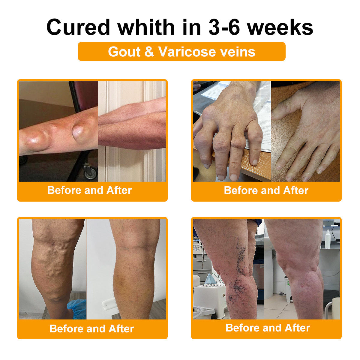 🔥Time-Limited Offer - ODALIT™ Botulinum Toxin & Bee Venom Pain-Relief Bone Healing Cream🐝💎