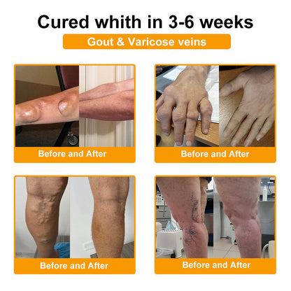 🔥Time-Limited Offer - ODALIT™ Botulinum Toxin & Bee Venom Pain-Relief Bone Healing Cream🐝💎