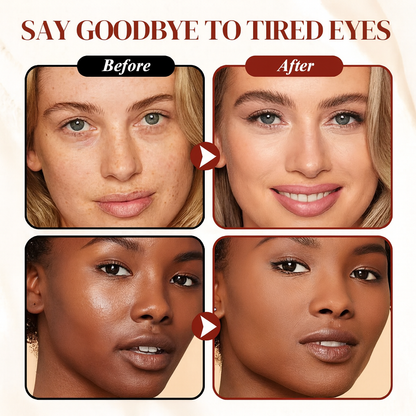 ✨ LAST DAY PROMOTION - BUY 1 GET 1 FREE✨Colored Clay Undereye Corrector