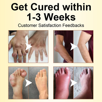 ODALIT™ Magnesium Oil & Bee Venom Joint Healing Spray🐝