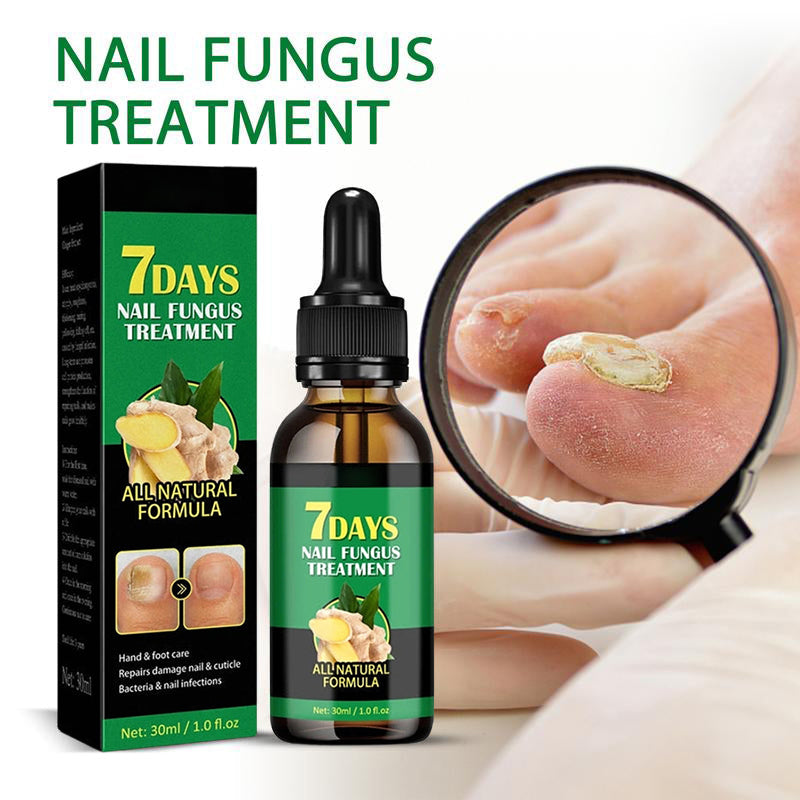 💅Refuse nail rot, ginger nail treatment👣