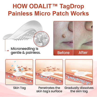 💥ODALIT™ painless micro-patch🔥🔥