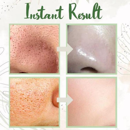 Green Tea Deep Cleanse Mask - （Limited time discount 🔥 last day）