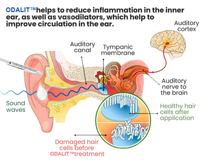 👂ODALIT™ Tinnitus Relief Ear Drops💥