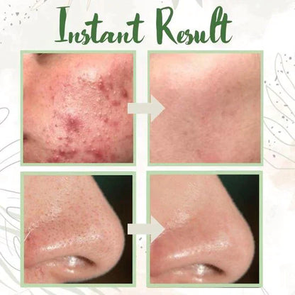 Green Tea Deep Cleanse Mask - （Limited time discount 🔥 last day）