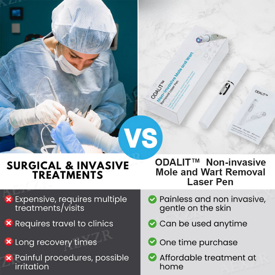 💥ODALIT™ Non-Invasive Mole and Wart Removal Laser Pen