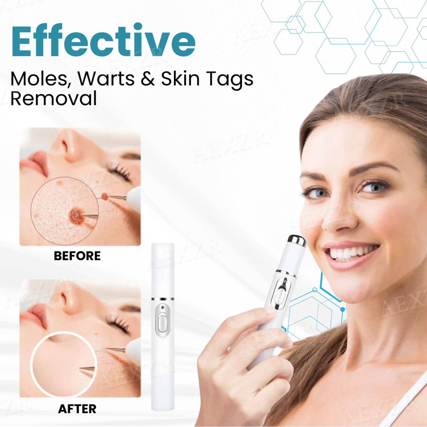 💥ODALIT™ Non-Invasive Mole and Wart Removal Laser Pen