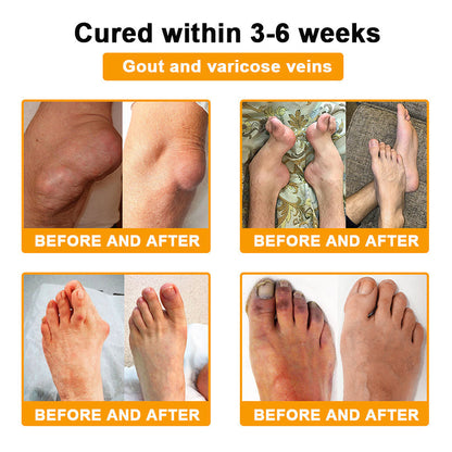 🔥Time-Limited Offer - ODALIT™ Botulinum Toxin & Bee Venom Pain-Relief Bone Healing Cream🐝💎