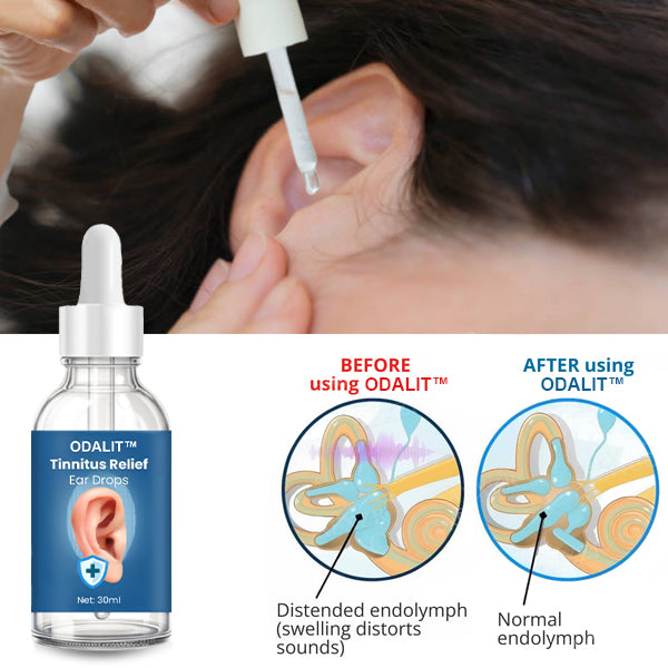 👂ODALIT™ Tinnitus Relief Ear Drops💥