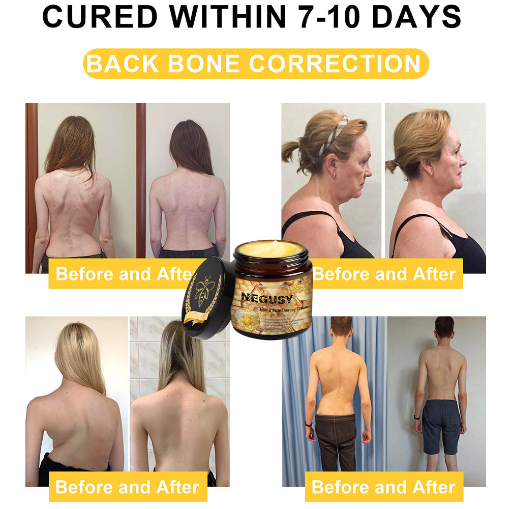 🐝Quick natural repair for sciatica, knee and back pain🐝