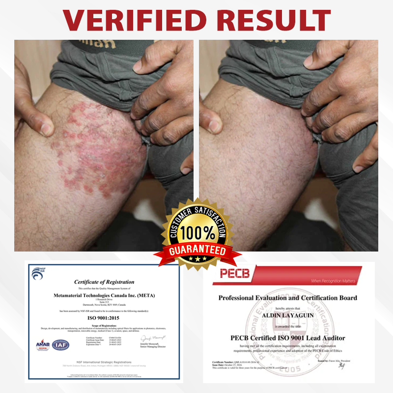 Fivfivgo® Men's HPV Warts Care Spray