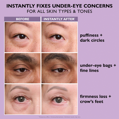 💥Last Day 49% OFF 🪄No-Filter Eye Tightener