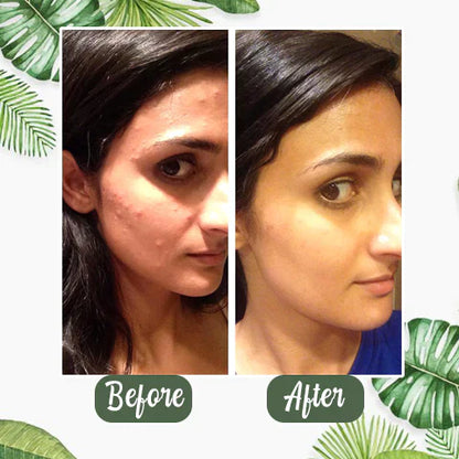 Green Tea Deep Cleanse Mask - （Limited time discount 🔥 last day）