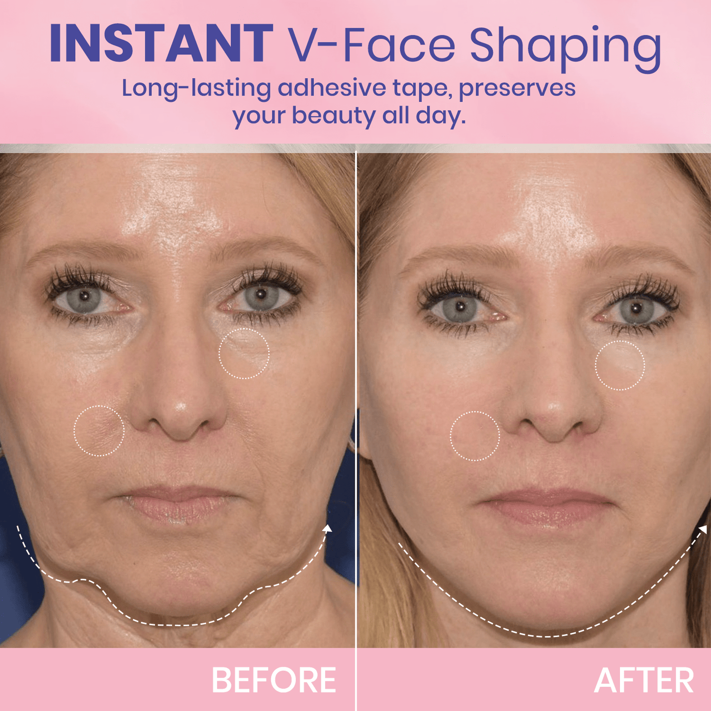 💖🎁Last Day 50% OFF-LBMLBM™ V-Face Lifting Invisible Adhesive Tape