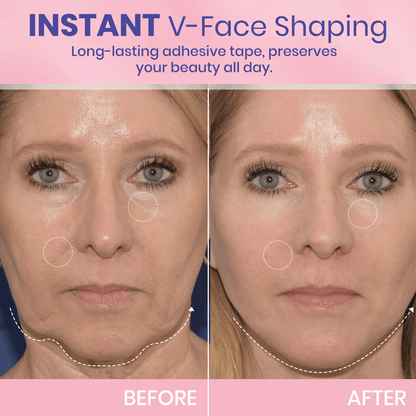 💖🎁Last Day 50% OFF-LBMLBM™ V-Face Lifting Invisible Adhesive Tape